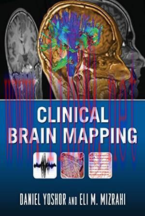 [PDF]Clinical Brain Mapping