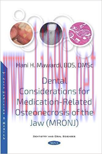 [PDF]Dental Considerations for Medication-related Osteonecrosis of the Jaw Mronj