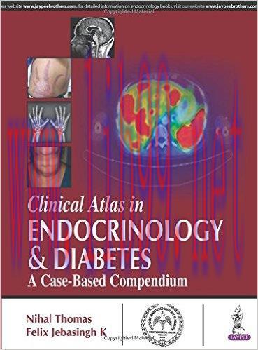 [AME]Clinical Atlas in Endocrinology and Diabetes: A Case-Based Compendium (PDF)