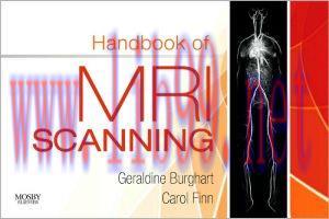 [AME]Handbook of MRI Scanning (PDF)