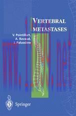 [PDF]Vertebral metastases