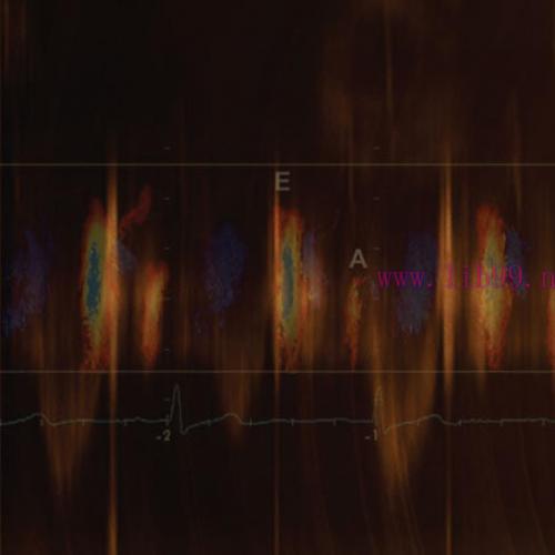 [AME]Mayo Clinic Echocardiography Online Board Review 2021 (Videos + Audios + Slides + Assessme...