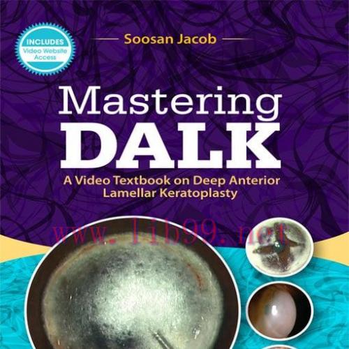[AME]Mastering DALK: A Video Textbook on Deep Anterior Lamellar Keratoplasty (EPUB)