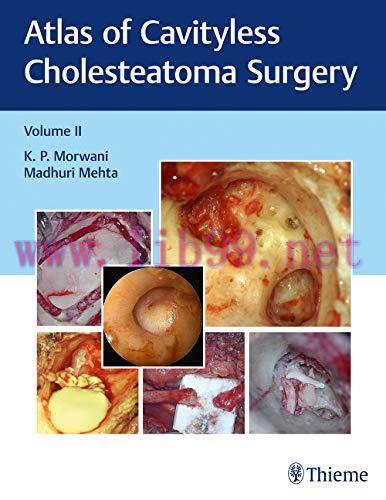 [AME]Atlas of Cavityless Cholesteatoma Surgery (Volume 2) (Original PDF)