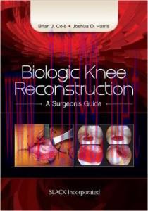 [AME]Biologic Knee Reconstruction: A Surgeon's Guide