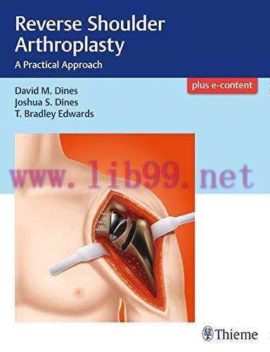 [AME]Reverse Shoulder Arthroplasty: A Practical Approach (PDF)