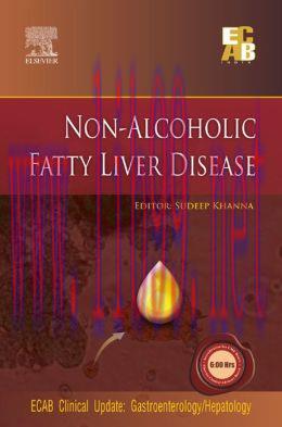 [AME]Non-Alcoholic Fatty Liver Disease &ndash; ECAB