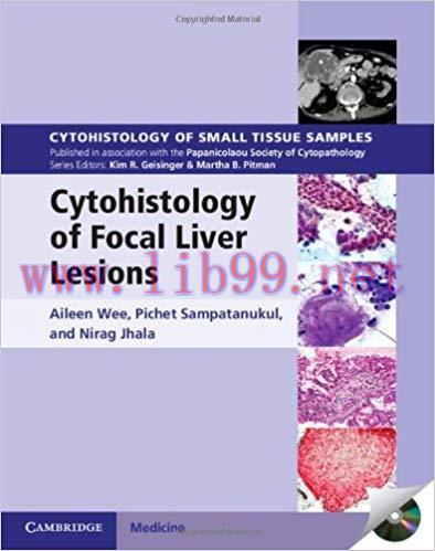 [PDF]Cytohistology of Focal Liver Lesions