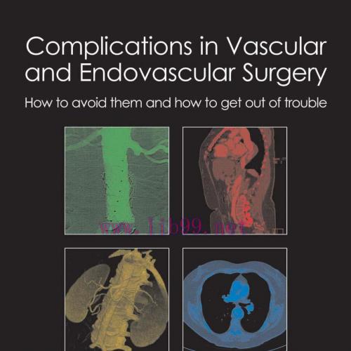 [AME]Complications in Vascular and Endovascular Surgery: How to avoid them and how to get out o...