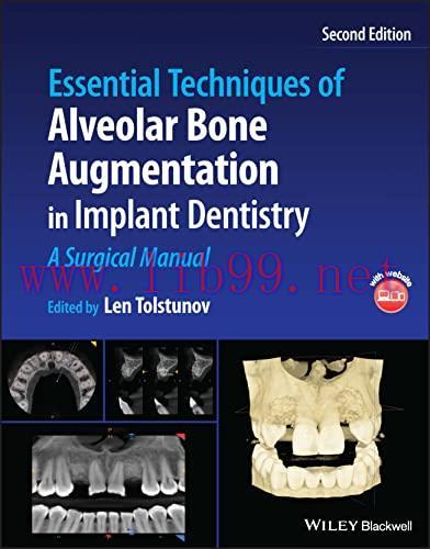 [AME]Essential Techniques of Alveolar Bone Augmentation in Implant Dentistry A Surgical Manual,...