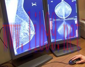 [AME]Comprehensive Review of Breast Imaging (5 in 1) 2013 (CME Videos)
