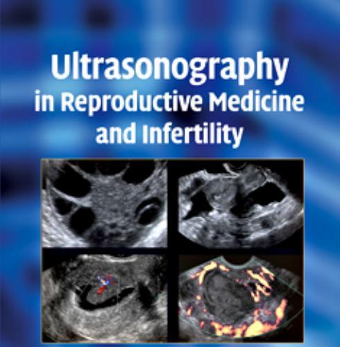 Ultrasonography in Reproductive Medicine and Infertility - Rizk Botros R. M. B_