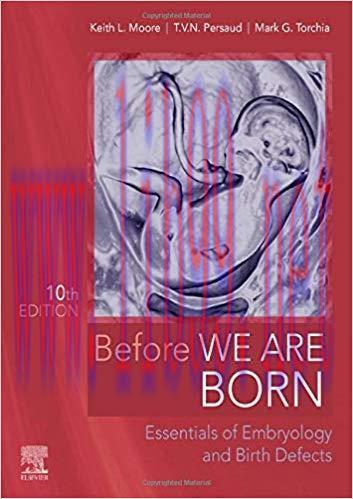 [PDF]Before We Are Born: Essentials of Embryology and Birth Defects 10th Edition