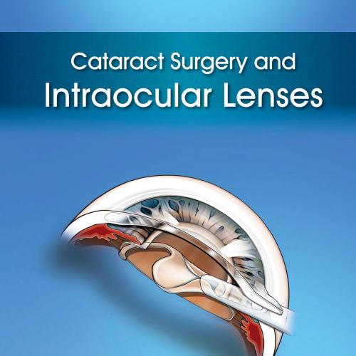 Cataract Surgery and Intraocular Lenses