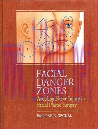 [AME]Facial Danger Zones: Avoiding Nerve Injury in Facial Plastic Surgery, 2ed (Original PDF)