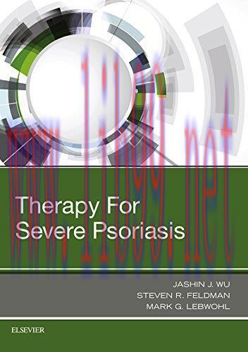 [AME]Therapy for Severe Psoriasis (PDF)