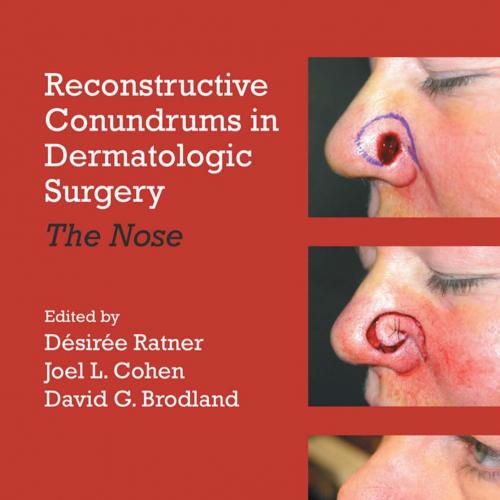 Reconstructive Conundrums in Dermatologic Surgery-The Nose