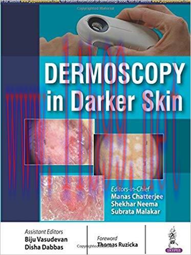 [PDF]Dermoscopy in Darker Skin
