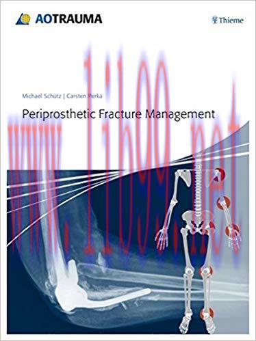 [PDF]Periprosthetic Fracture Management