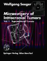 [PDF]Microsurgery of Intracranial Tumors: Vol 1: Supratentorial Tumors