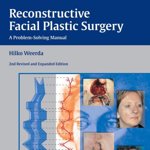 Reconstructive Facial Plastic Surgery A Problem-Solving Manual 2nd Edition - Hilko Weerda