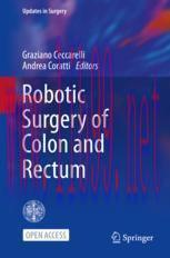[PDF]Robotic Surgery of Colon and Rectum