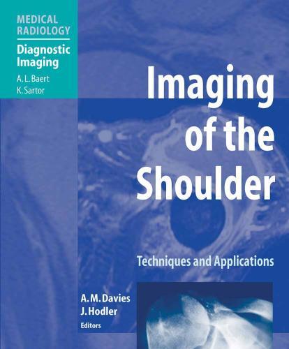 Imaging of the Shoulder