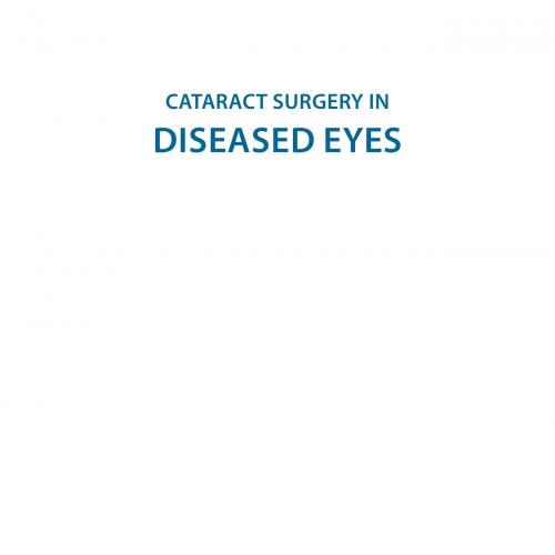 Cataract Surgery in Diseased Eyes