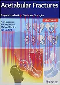 [PDF]Acetabular Fractures Diagnosis, Indications, Treatment Strategies (包含视频)