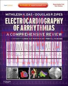 [AME]Electrocardiography of Arrhythmias: A Comprehensive Review: A Companion to Cardiac Electro...