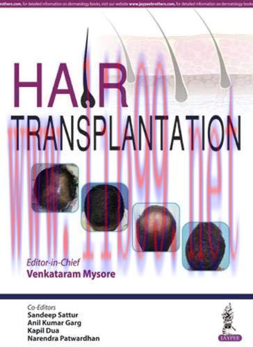 [AME]Hair Transplantation (Original PDF)