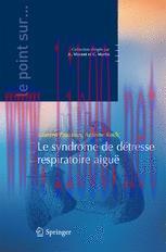 [PDF]Le syndrome de d&eacute;tresse respiratoire aigu&euml;