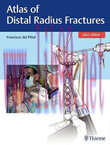 [AME]Atlas of Distal Radius Fractures 1st edition (PDF)