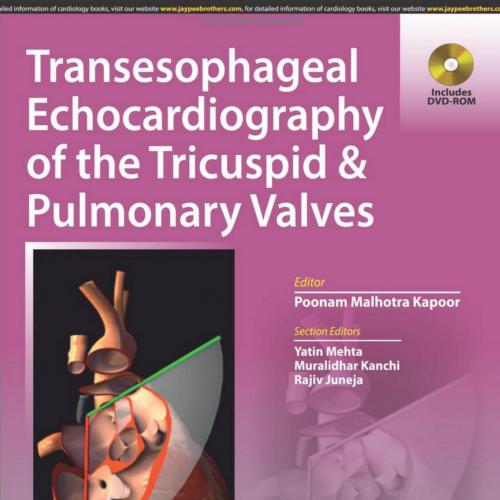 Transesophageal Echocardiography of the Tricuspid and Pulmonary Valves
