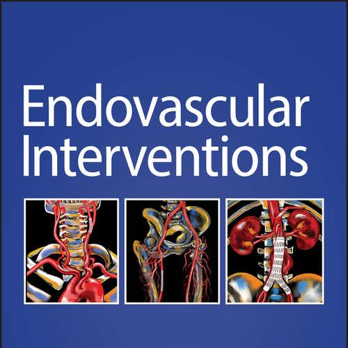 Endovascular Interventions