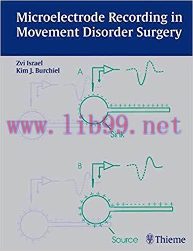 [PDF]Microelectrode Recording in Movement Disorder Surgery