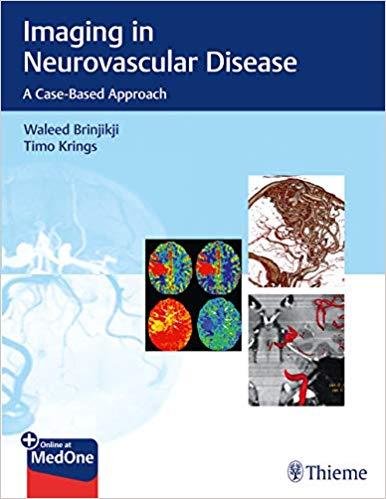 Imaging in Neurovascular Disease A Case-Based Approach