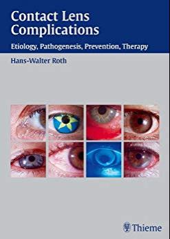 Contact Lens Complications, 1e [Thieme] [2003]