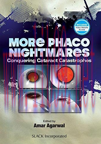[AME]More Phaco Nightmares: Conquering Cataract Catastrophes (PDF)