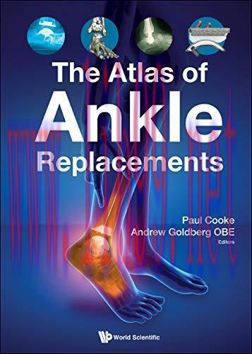 [AME]The Atlas of Ankle Replacements (Original PDF)