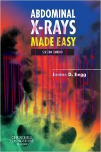 [AME]Abdominal X-Rays Made Easy, 2nd Edition