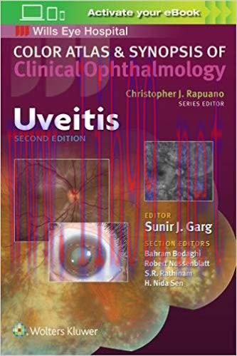 [EPUB]Uveitis (Color Atlas and Synopsis of Clinical Ophthalmology)，2nd Edition