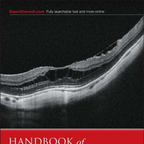 Handbook of Retinal OCT Optical Coherence Tomography, 1e
