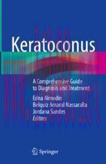 [PDF]Keratoconus : A Comprehensive Guide to Diagnosis and Treatment