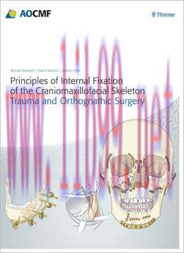 [AME]Principles of Internal Fixation of the Craniomaxillofacial Skeleton (Original PDF)