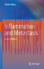 [PDF]Inflammation and Metastasis