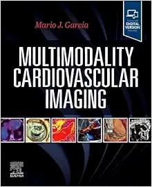 [AME]Multimodality Cardiovascular Imaging (True PDF)