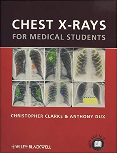 Chest X-rays for Medical Students