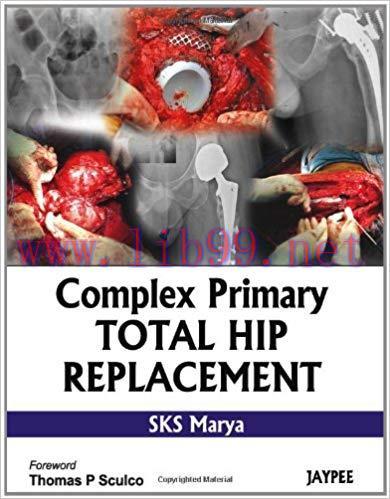 [PDF]Complex Primary Total Hip Replacement