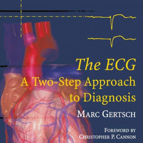 The ECG A Two-Step Approach to Diagnosis 2004th Edition